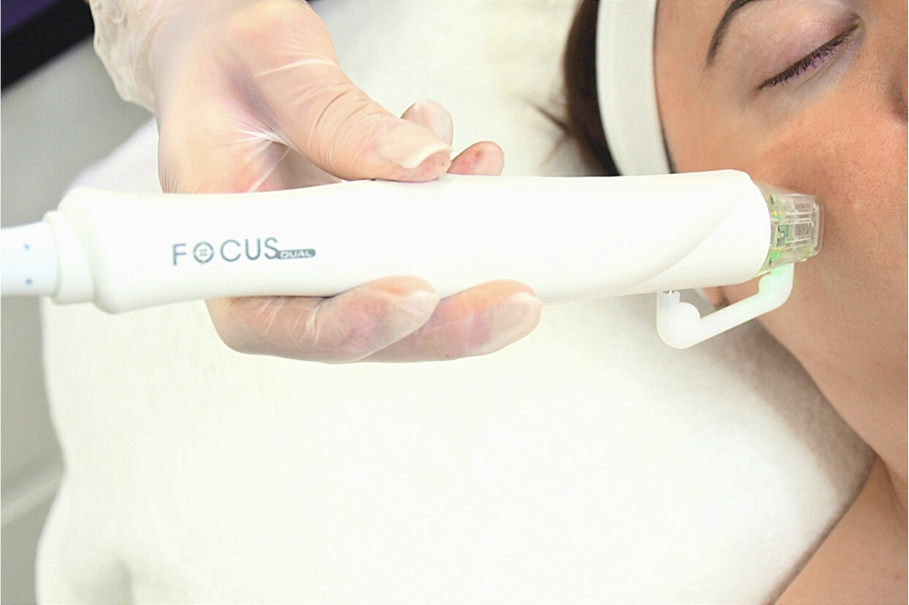 Focus Dual RF Microneedling