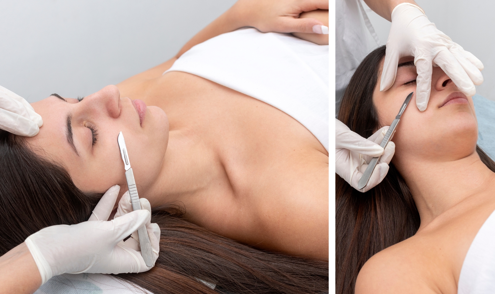 Dermaplaning Hampshire